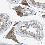 TMEM41B Antibody in Immunohistochemistry (Paraffin) (IHC (P))