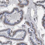 SLC37A2 Polyclonal Antibody