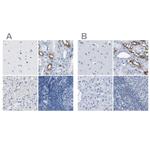 NKCC2 Antibody in Immunohistochemistry (IHC)