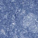 NKCC2 Antibody in Immunohistochemistry (IHC)