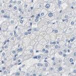 NKCC2 Antibody in Immunohistochemistry (IHC)