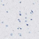 NKCC2 Antibody in Immunohistochemistry (IHC)