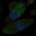 NKCC2 Polyclonal Antibody