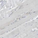 ST6GALNAC1 Antibody in Immunohistochemistry (Paraffin) (IHC (P))