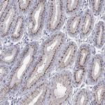 ST6GALNAC1 Antibody in Immunohistochemistry (Paraffin) (IHC (P))