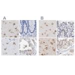PNMA1 Antibody in Immunohistochemistry (IHC)