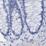 PNMA1 Antibody in Immunohistochemistry (IHC)