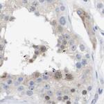 PNMA1 Antibody in Immunohistochemistry (IHC)