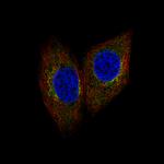 SCYL1 Polyclonal Antibody