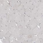 LPHN3 Antibody in Immunohistochemistry (Paraffin) (IHC (P))