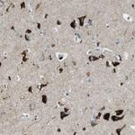 TMEM234 Antibody in Immunohistochemistry (Paraffin) (IHC (P))