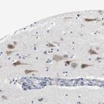 CNGA2 Polyclonal Antibody