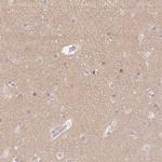 Catenin delta-2 Antibody in Immunohistochemistry (Paraffin) (IHC (P))