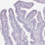 Catenin delta-2 Polyclonal Antibody