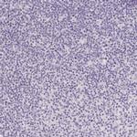 Catenin delta-2 Antibody in Immunohistochemistry (Paraffin) (IHC (P))