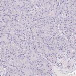 Catenin delta-2 Antibody in Immunohistochemistry (IHC)