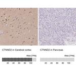 Catenin delta-2 Antibody