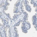 EQTN Antibody in Immunohistochemistry (IHC)
