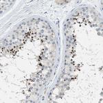 EQTN Antibody in Immunohistochemistry (IHC)