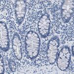 EQTN Antibody in Immunohistochemistry (IHC)