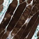 PSKH2 Polyclonal Antibody