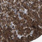 DENND4C Antibody in Immunohistochemistry (Paraffin) (IHC (P))