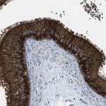 UGGT1 Polyclonal Antibody