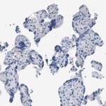 FCGRT Polyclonal Antibody