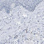 FCGRT Antibody in Immunohistochemistry (Paraffin) (IHC (P))