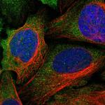 LRRC37B Polyclonal Antibody