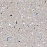 LRRC37B Antibody in Immunohistochemistry (Paraffin) (IHC (P))
