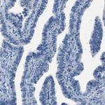 LRRC37B Antibody in Immunohistochemistry (Paraffin) (IHC (P))