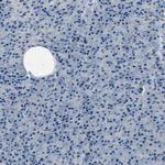 LRRC37B Antibody in Immunohistochemistry (Paraffin) (IHC (P))