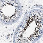 LRRC37B Antibody in Immunohistochemistry (IHC)