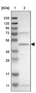 SLC41A1 Antibody in Western Blot (WB)