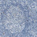 KCTD3 Antibody in Immunohistochemistry (Paraffin) (IHC (P))
