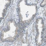 KCTD3 Antibody in Immunohistochemistry (Paraffin) (IHC (P))
