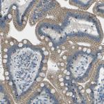 KCTD3 Antibody in Immunohistochemistry (Paraffin) (IHC (P))