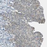 KCTD3 Antibody in Immunohistochemistry (Paraffin) (IHC (P))