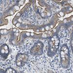 PREX2 Antibody in Immunohistochemistry (IHC)