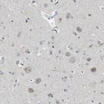 PFTK1 Antibody in Immunohistochemistry (Paraffin) (IHC (P))