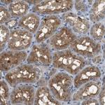PFTK1 Antibody in Immunohistochemistry (Paraffin) (IHC (P))