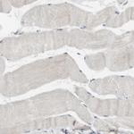 PFTK1 Antibody in Immunohistochemistry (Paraffin) (IHC (P))