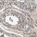 PFTK1 Antibody in Immunohistochemistry (Paraffin) (IHC (P))