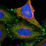 TES Polyclonal Antibody