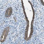TES Antibody in Immunohistochemistry (Paraffin) (IHC (P))