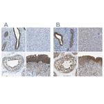 TES Antibody in Immunohistochemistry (Paraffin) (IHC (P))