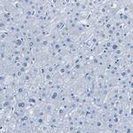 TES Antibody in Immunohistochemistry (Paraffin) (IHC (P))