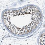 TES Antibody in Immunohistochemistry (Paraffin) (IHC (P))