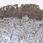 TES Antibody in Immunohistochemistry (Paraffin) (IHC (P))